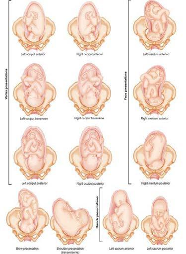 Fetal Positions Before Birth
